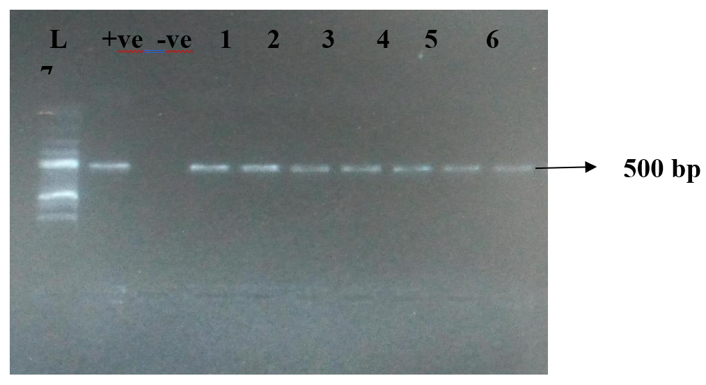 Electrophoresis Gel Picture of the oprL Gene